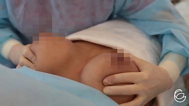 Moskova, Rusya'dan Ekaterina Litvinova kameraman - Операция по увеличению груди, Kurumsal video, erotik
